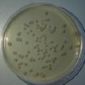 Escherichia coli A B C D E: