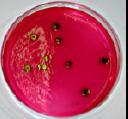 Staphylococcus aureus G: