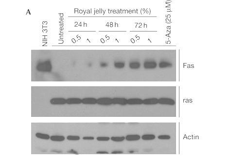 Cell line models; reduce DNA methylation chemically/pharmaceutically 5-aza-2 -deoxycytidine Western blot of proteins extracted from cell line in which Fas is methylated No expression of Fas detected
