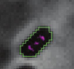 Chapter 3: Chromosome organization by a nucleoid-associated protein in live E.