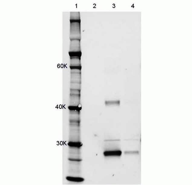(M11217) in IP Hela cells were transduced with adenovirus-mcherry using the Novex Immunoprecipitation Kit Dynabeads Protein G (Product # 10007D).