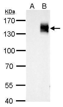(PA5-34974) in WB Western blot analysis of mcherry using A) 30 µg 293T whole cell lysate and B) 30 µg whole cell lysate of mcherry-tagged protein