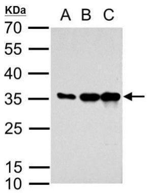 (PA5-34974) in WB Western blot analysis of mcherry using A) 5ng recombinant mcherry (B) 10ng recombinant mcherry and C) 20ng recombinant mcherry.