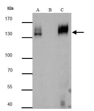 (PA5-34974) in IP PA5-34974 immunoprecipitates mcherry protein in IP experiments.