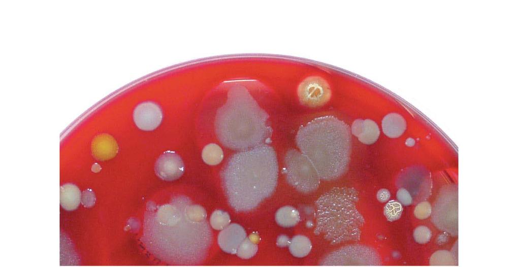 Figure 1.16 Bacterial colonies on a solid surface (agar).