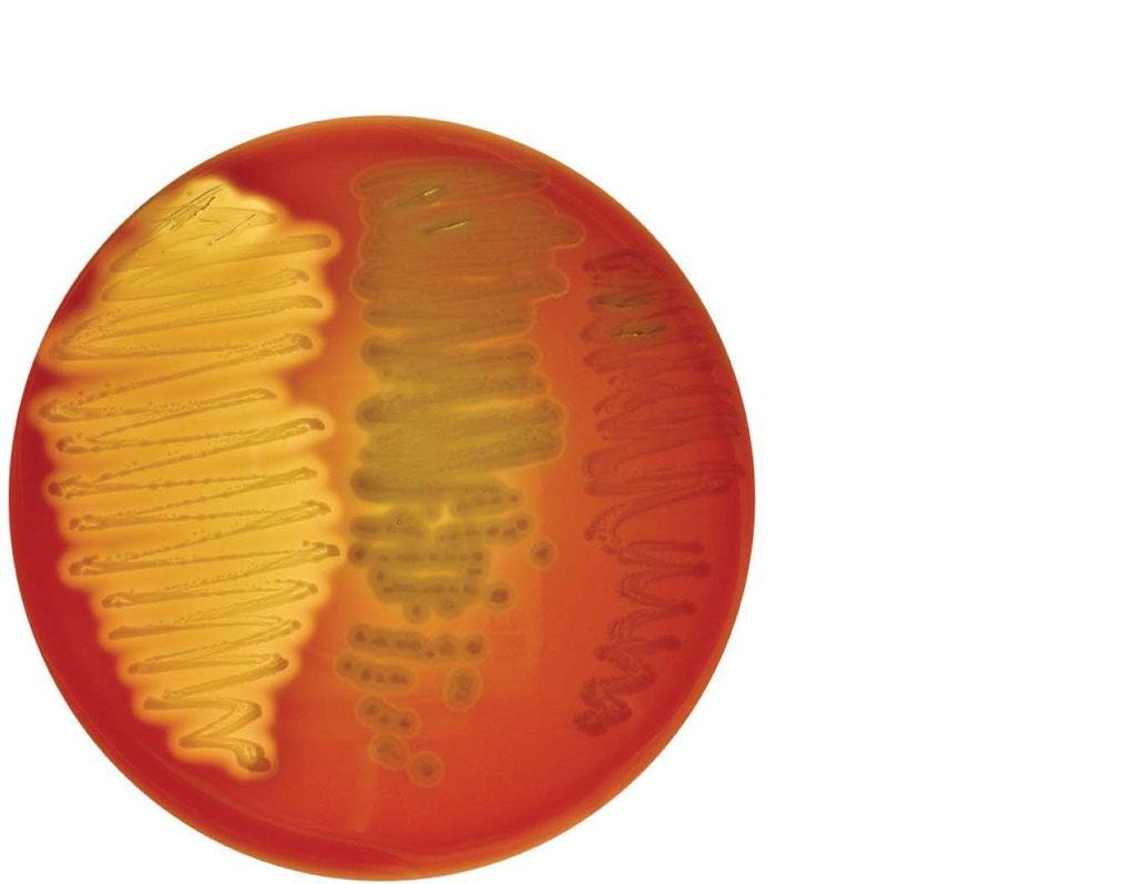 Figure 6.13 The use of blood agar as a differential medium.