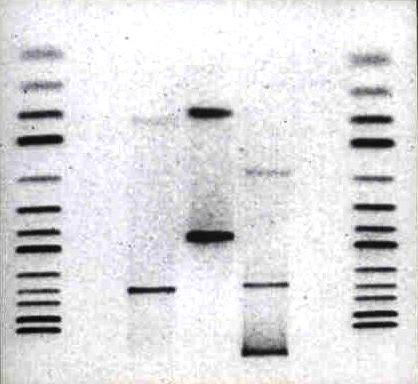 Appearance of separated fragments on gel These bands will contain the shorter DNA fragments These bands will contain