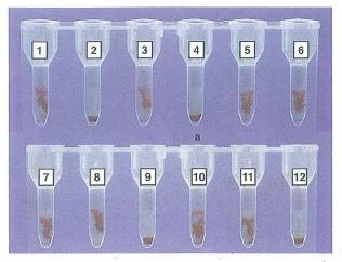 DAT using the microcolumn (gel) system Gel microcolumn assay (GMA) has been shown to be more sensitive than the conventional tube test for detecting potentially significant