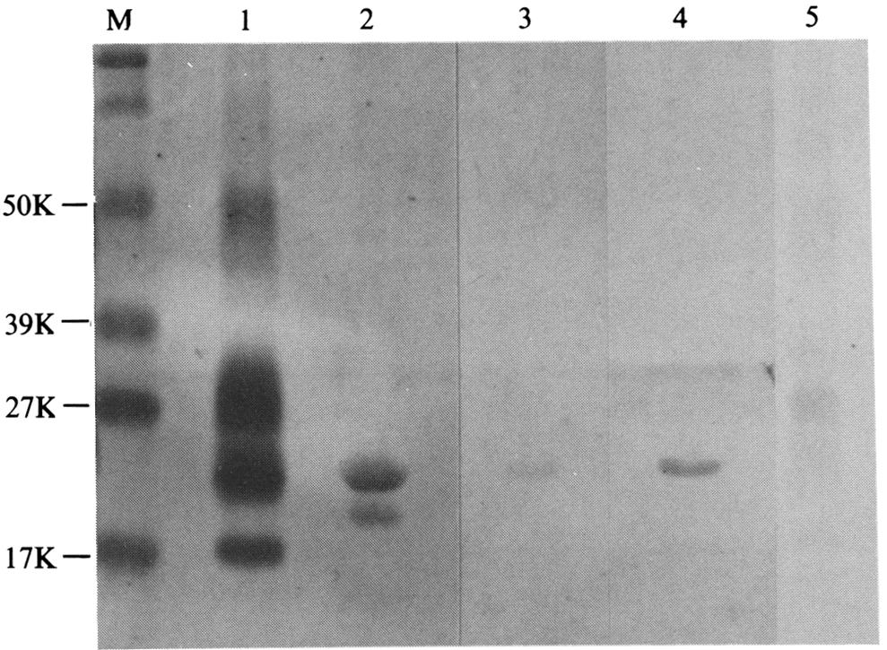 were detected (Fig. 2, lane 5). Thus, the PrP-res detected at 1 week p.i. could, at least in part, have been derived from inoculum if all of the intracerebrally inoculated PrP-res were sequestered in the spleen by 1 week p.