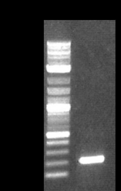 M IPTG stock solution were also plated if blue-white screen ing looking for the clones containing recombinant DNA would be carried out. DNA sequencing of construct.