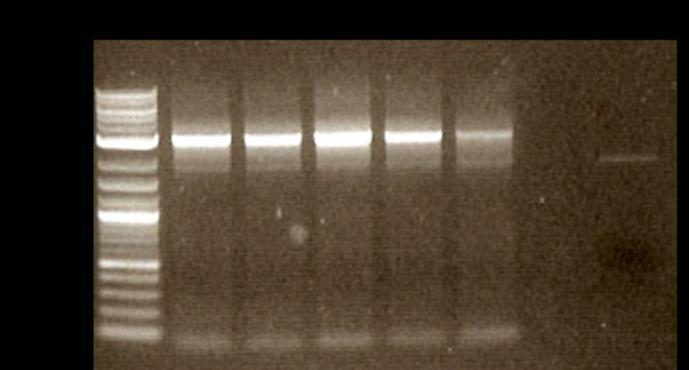 FIG 3 1% agarose gel showing PCR amplification of pcxz14w plasmid fragment with intervening sequence deleted. Lanes 1-5 contain PCR products using pcxz14w as the template.