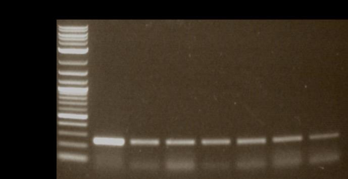 1% agarose gel showing colony PCR amplification of colonies harboring pcxz14w plasmid with intervening sequence potentially deleted.