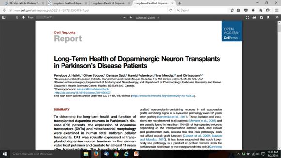 transplant, 12% of neurons had Lewy Body pathology.