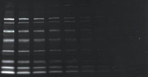 iblot Transfer System post-electrophoresis, gels were placed on a Mini Nitro iblot stack and assembled on the iblot system following manufacturer s instructions.