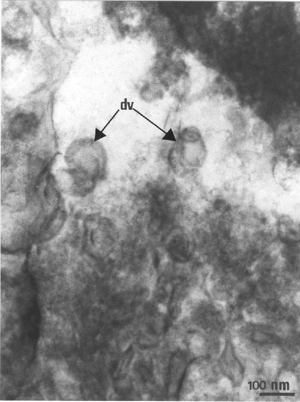 Under TEM, tumour cells derived from lentinan-treated mice were generally highly vacuolated and disintegrating.
