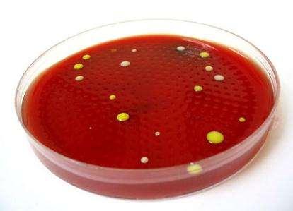 MO Plate Counts Trt MO Biomass Fungi Bacteria (ug/g) (cfu/g) (x1,000) Manured 371 29.
