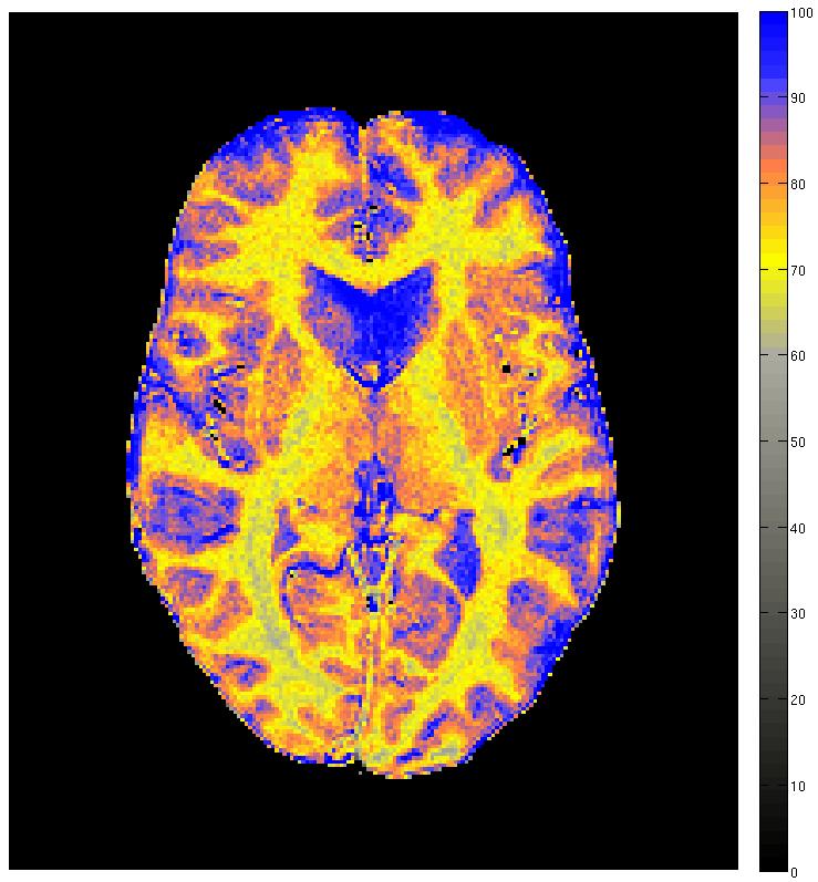 Quantitative imaging Quantitative imaging of the brains a challenging perspective in the MRI