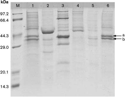 Emergence of carbapenem-resistant Enterobacteriaceae Fig. 2. SDS-PAGE analysis of outer-membrane proteins of K. pneumoniae clinical isolates (partial results).