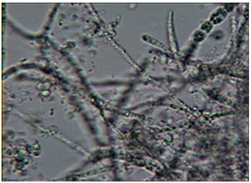 Shabani & Devolli: MICROBIAL SPOILAGE IN BEER PROCESSING BY BIOFILMS 4 cm. The biofilm was about 1-2 mm high and 6 mm in width, therefore it was considered as a mature one.
