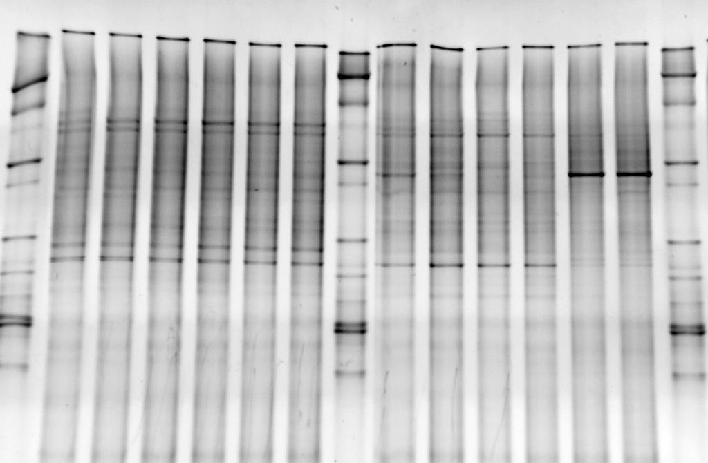 Results Biodiversity DGGE fingerprint Vertical lane = sample Band = individual micro-organism T=0