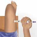 If you do not hear a click, your injection was not given the right way.