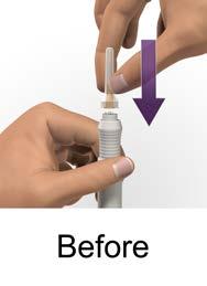 Figure E). Only use the needle that comes with your AVONEX PEN.
