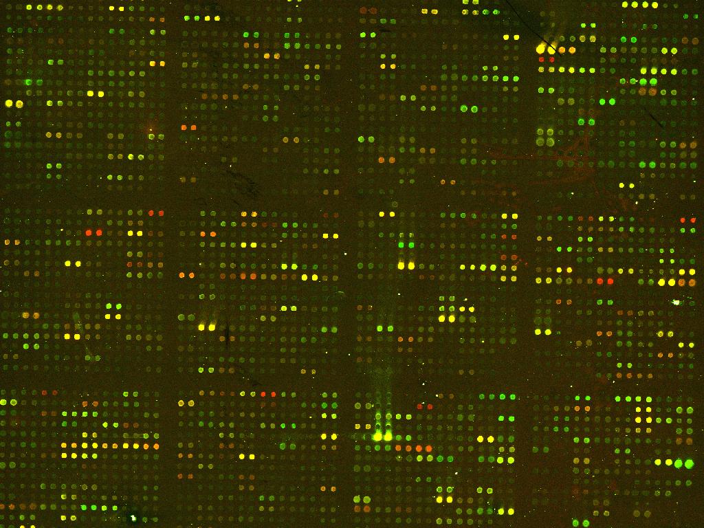 gene-specific DNA strands tissue A tissue B tissue C ErbB2 0.02 1.12 2.