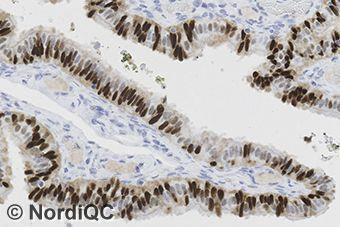 In this assessment the pab 10336-1-AP (Protein Tech) was the most successful polyclonal antibody with a pass rate of 91% (10 of 11). Sufficient staining was achieved on all major staining platforms.