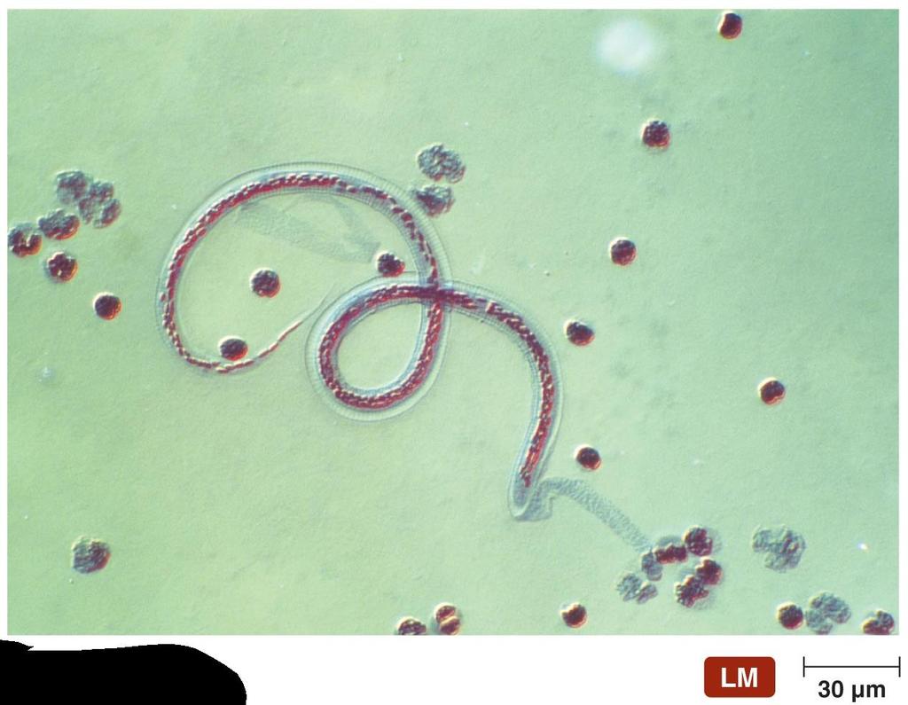 An immature stage of a parasitic worm in