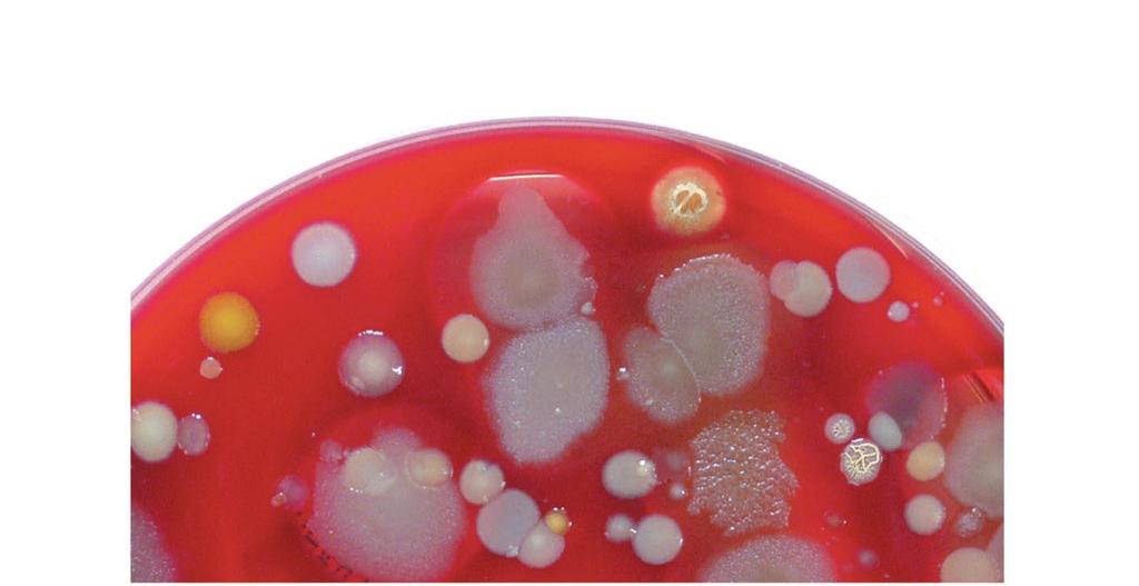 Bacterial colonies on a solid surface (agar) Bacterium 2 Bacterium 1 Bacterium 3 Bacterium 4
