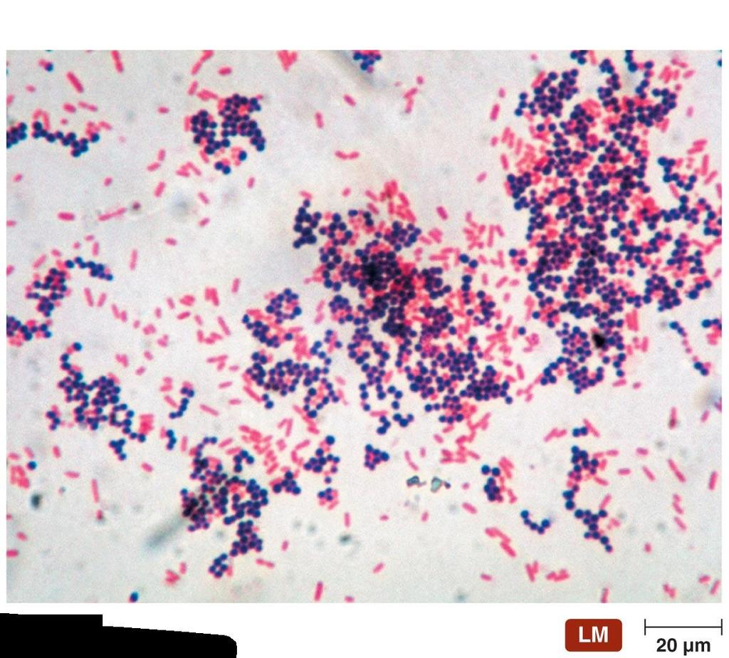 Results of Gram staining