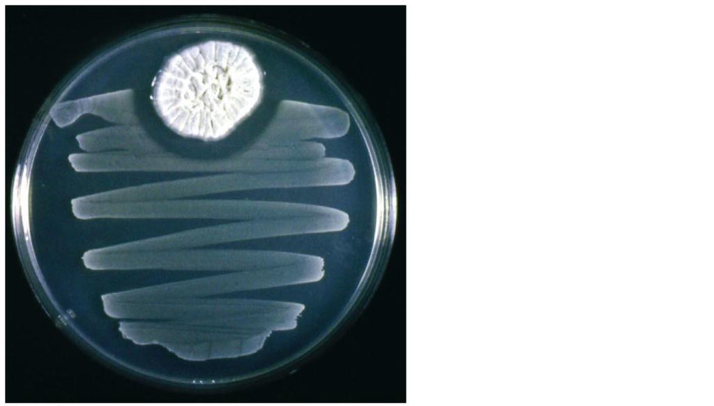 The effects of penicillin on a bacterial "lawn" in a Petri dish.