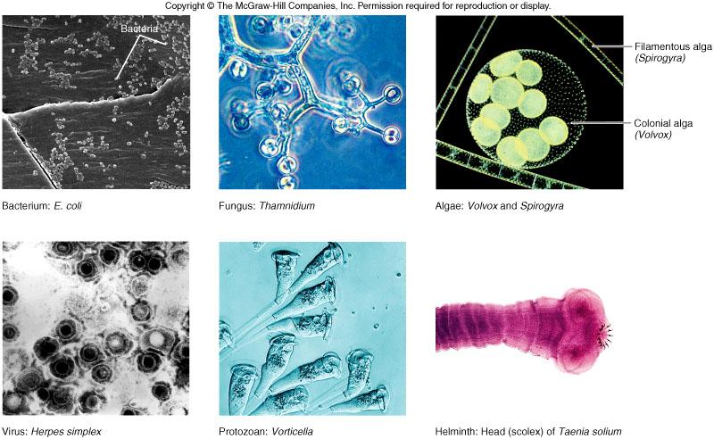 There are six main types of microbes: 1.) Bacterium or Archaeon, 2.) Fungus, 3.) Alga, 4.