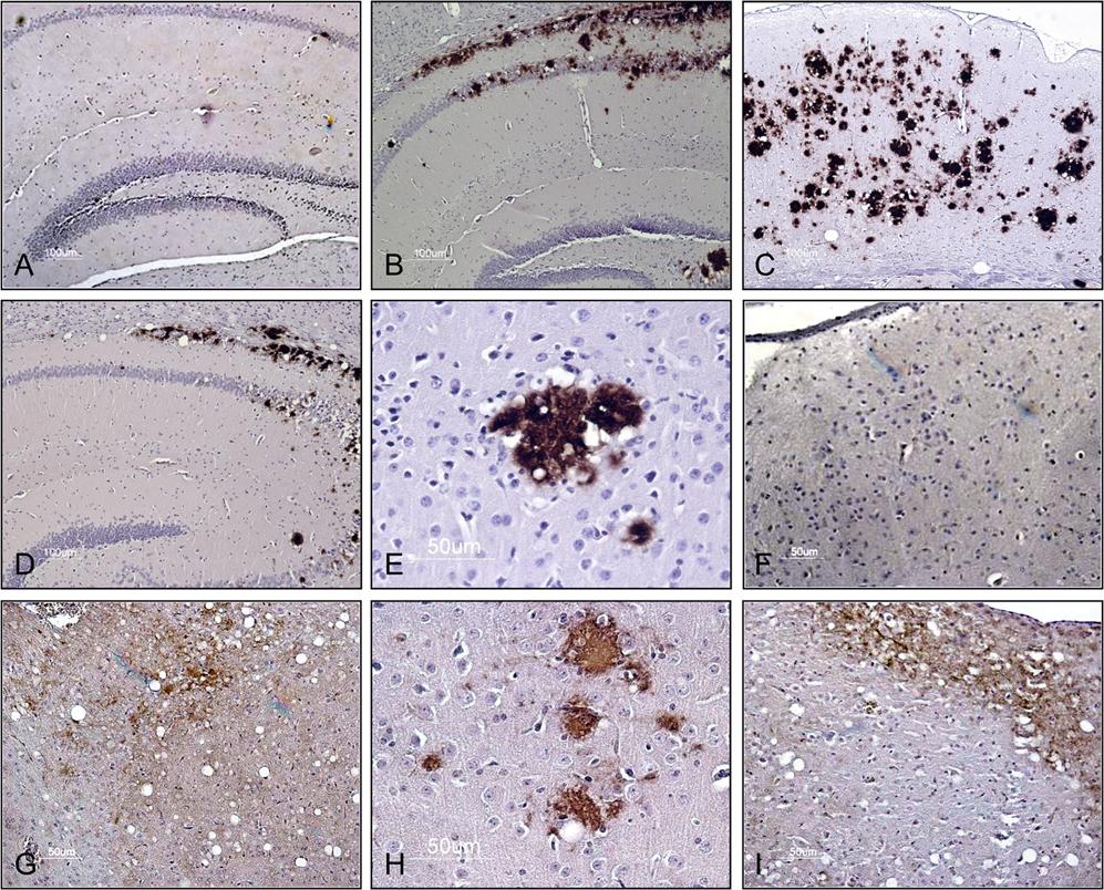 Accelerated Prion Propagation Figure 5. Immunohistochemical detection of CerPrPSc and spongiform degeneration in the brains of diseased Tg(CerPrP)1536+/2 mice.