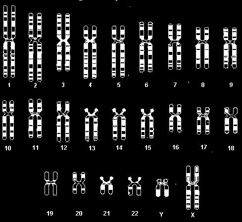 Chromosome Banding Patterns www.