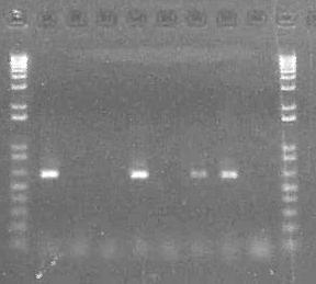Visualizing the DNA (ethidium bromide) wells DNA ladder 1 2 3 4 5 6 7 8 DNA ladder PCR Product Primer dimers 5,000