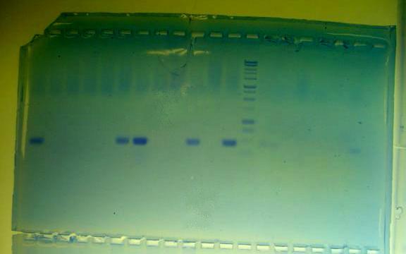 Visualizing the DNA (QuikVIEW stain) wells DNA ladder PCR Product + - - - - + + - - + - + 2,000