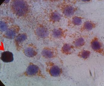 Furthermore, cell cultures were fixed and then performed staining.