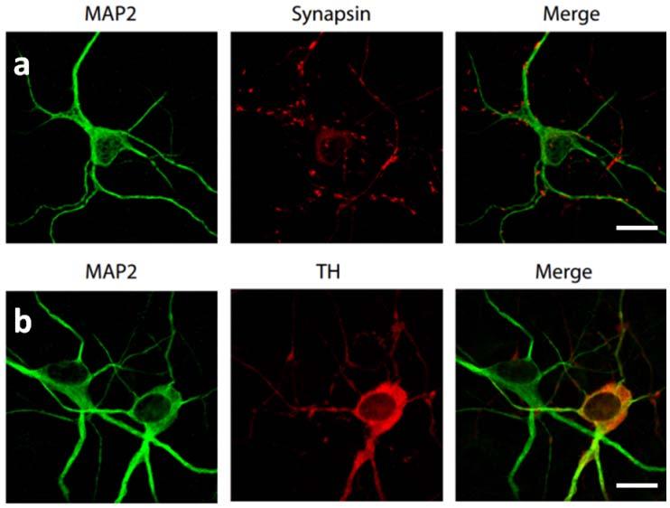 Supplementary Figure 10: Induced DA neurons stain positively for mature neuronal markers and dopamine markers.