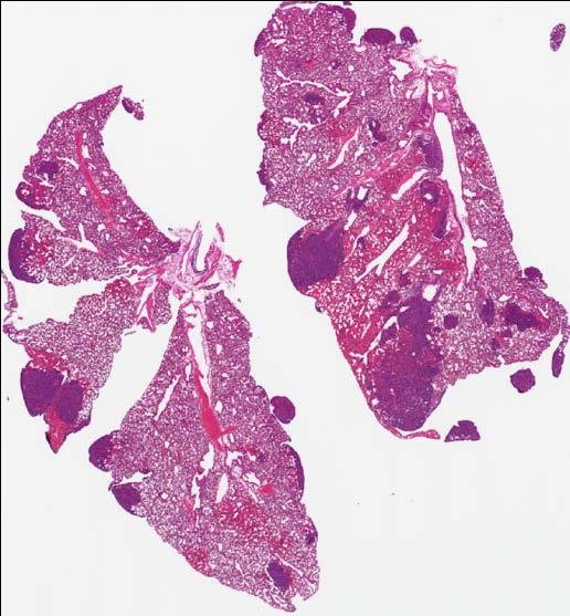 Lung Tumor Burden Quantification: Comparison to Established Morphometric Techniques 39 butterfly sections of mouse lungs Metastatic mammary carcinoma Formalin insufflated Hematoxylin and eosin