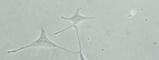 Figure 8: Human Cerebral Cortical neuronal cell culture grown in Celprogen s neuronal extracellular matrix coated tissue culture flask, 7 days in culture indicating neuronal connections of three
