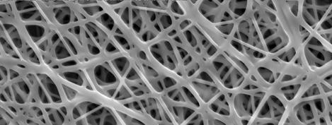 25- SEM micrographs of electrospun fibers showing diagonal alignment This diagonal alignment was confirmed by Fast Fourier Transform (FFT) which