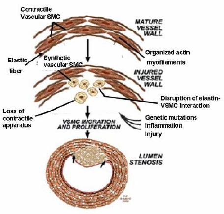 vascular elastin exposes other medial components (i.e. collagen, SMCs) to very high tensile stresses 208.