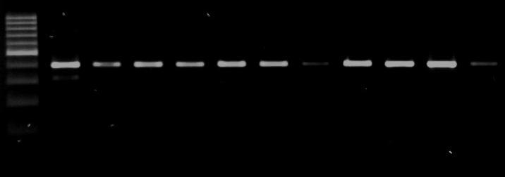 Figure 3. Visualization of GH AluI gene fragment PCR-RFLP on aragose gel 1.