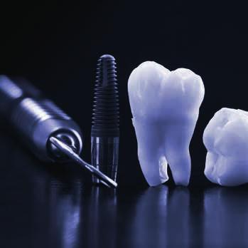 Applications Dental implants Biofilms form on any solid surface exposed to a biological environment. Protein adsorption is the initial step of biofilm formation and depends on surface characteristics.