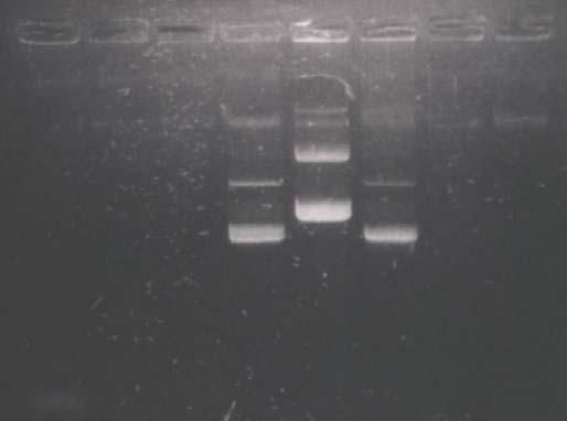 CONFIRMATION OF RECOMBINANT pgem-t Isolation of recombinant plasmid 1 2 3 Restriction Analysis of recombinant