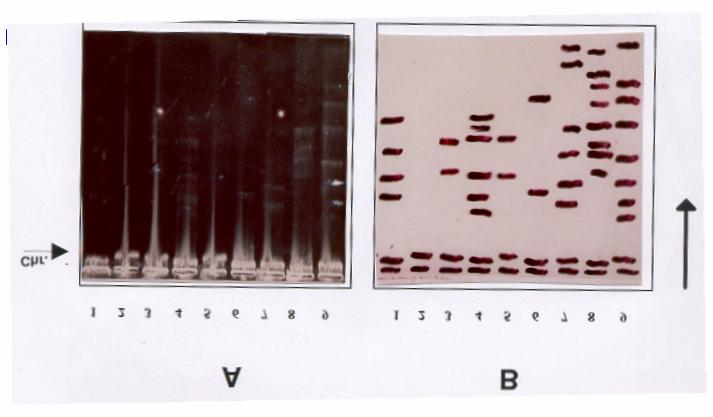 II Total average 9.5 36.5 23.2 ** Highly significant P value when less than 0.005. * Significant at 0.05. Fig. (1): Photocopy (a) and diagram (b) of plasmid patterns of some E. coli isolates.