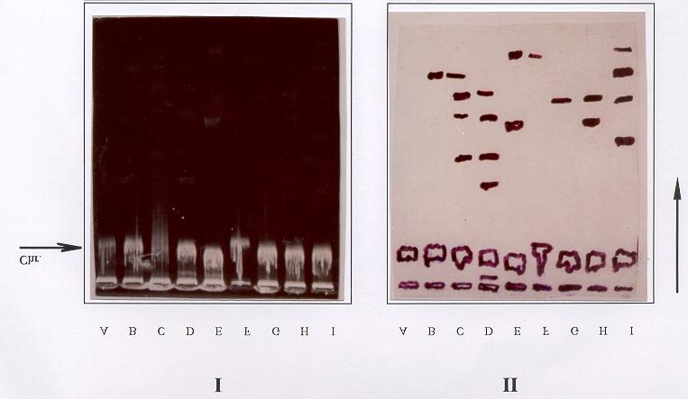 13 + 14 + + 15 + + * Obtained by selection on LB supplemented with CRO OFX and CRO/OFX. Fig. (2): Photocopy (I) and diagram (II) of plasmid patterns of some E. coli strains Lane A, E.