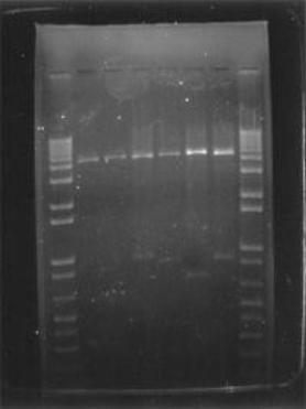 II. DNA Gel electrophoresis DNA electrophoresis is an analytical technique used to separate DNA fragments by size. An electric field forces the fragments to migrate through a gel.