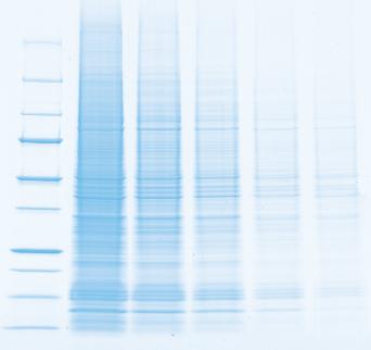 Chemiluminescent Western Blot Detection Superior Sensitivity Chemiluminescent western blot detection is a highly sensitive alternative to isotopic detection.